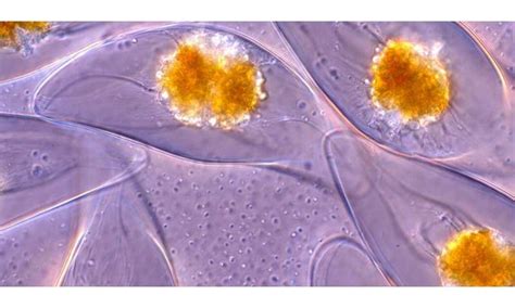  ウロプラズマ、驚くべき変形能力を持つ単細胞生物！